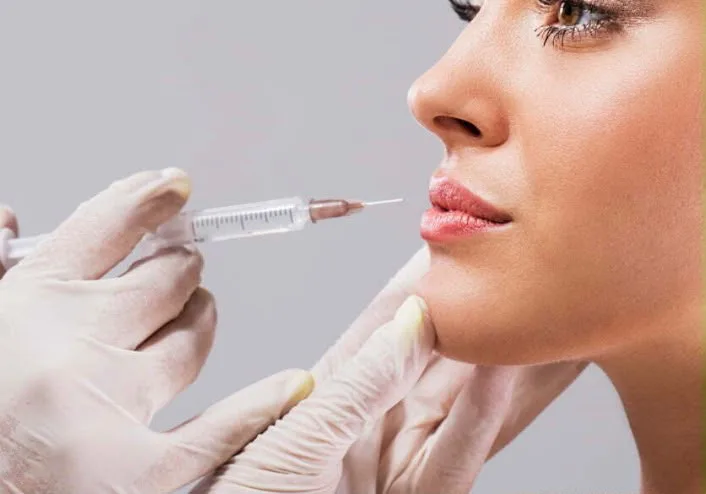 Lip Fillers