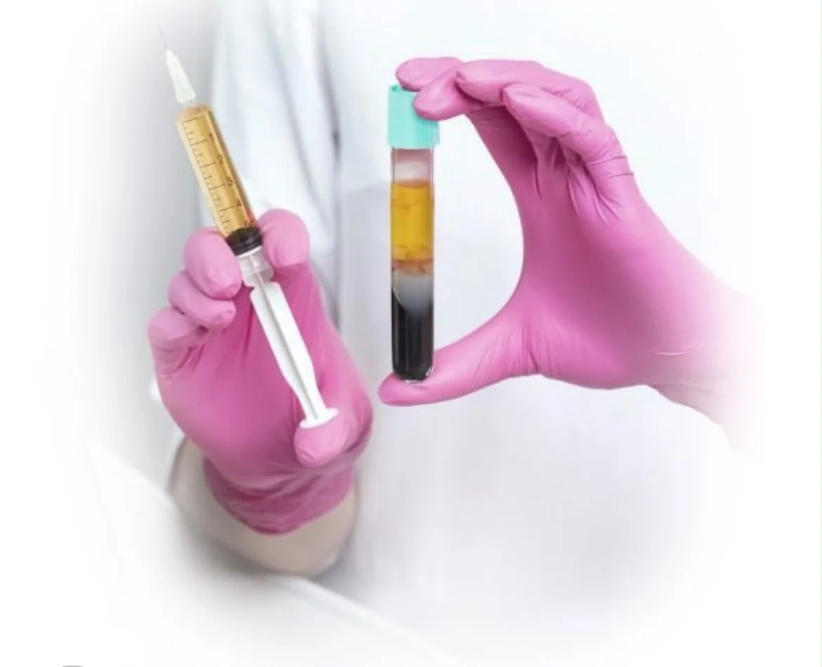 PRP Therapy