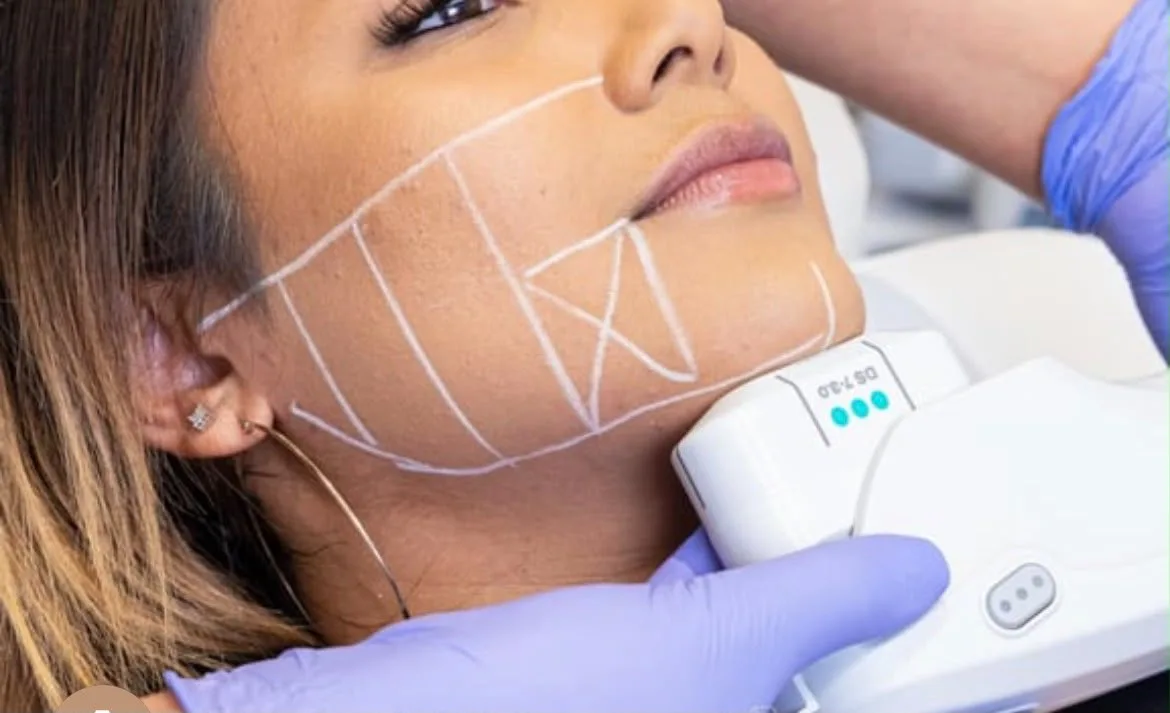 Ultherapy