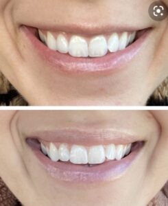 Butex Medical spa and Laser Treatment Botox