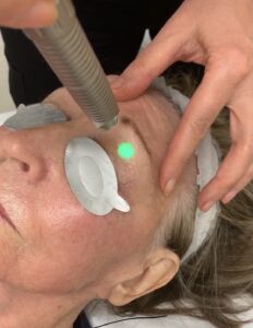 Butex Medical spa and Laser Treatment Laser Eye Treatment